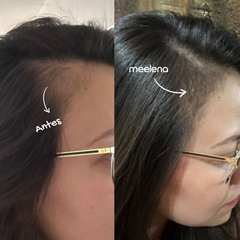 KIT 1: ANTICAÍDA + CRECIMIENTO + DOBLE REPARACIÓN