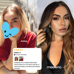 KIT 3: DOBLE CRECIMIENTO - ANTICAÍDA -DOBLE REPARACIÓN