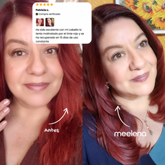 KIT 2: ANTICAÍDA + CRECIMIENTO + REPARACIÓN