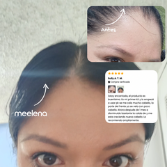 Aceite para crecimiento capilar Fórmula Mejorada