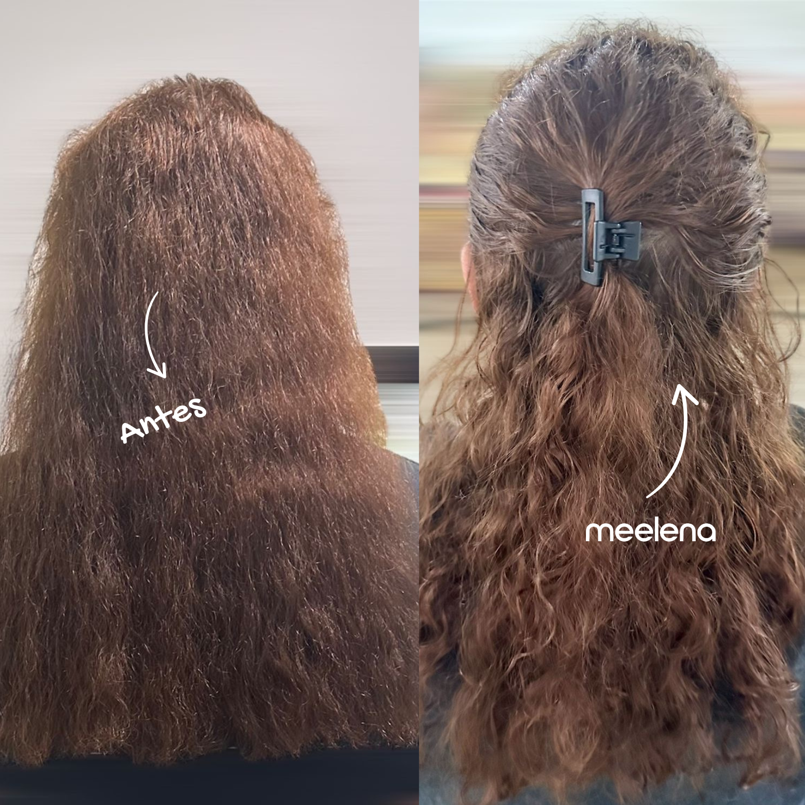 KIT 2: ANTICAÍDA + CRECIMIENTO + REPARACIÓN