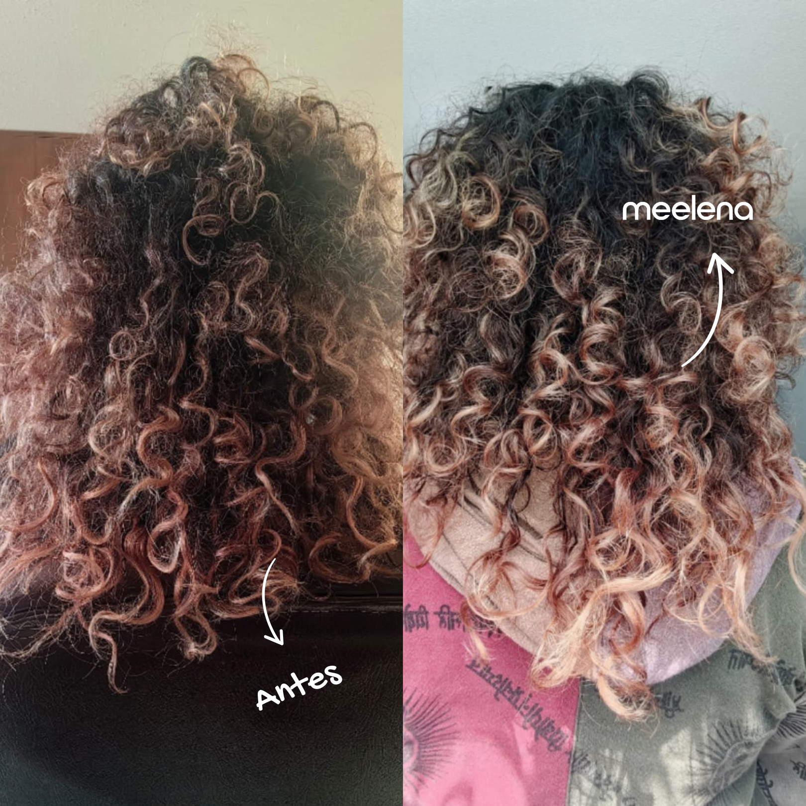 KIT 1: ANTICAÍDA + CRECIMIENTO +  DOBLE REPARACIÓN