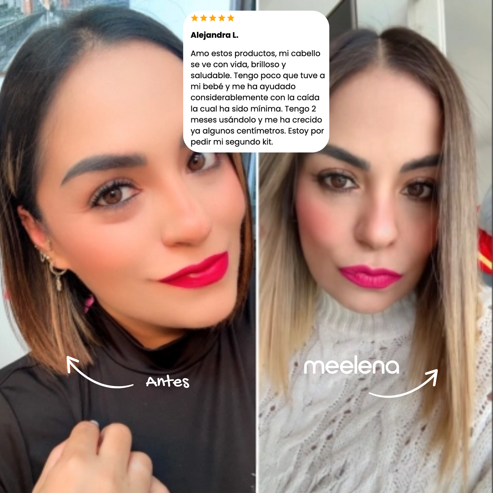 KIT 1: ANTICAÍDA + CRECIMIENTO +  DOBLE REPARACIÓN