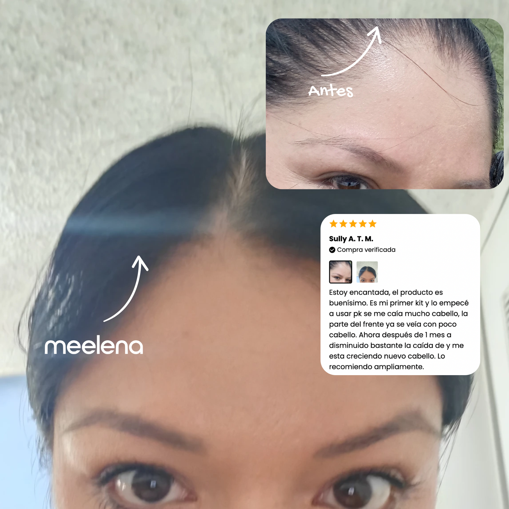 Aceite de romero para crecimiento capilar